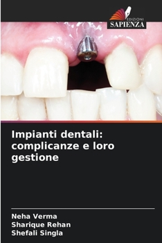 Paperback Impianti dentali: complicanze e loro gestione [Italian] Book