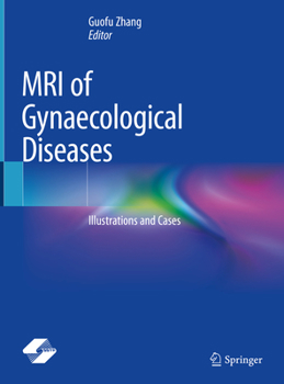 Hardcover MRI of Gynaecological Diseases: Illustrations and Cases Book
