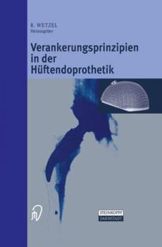Verankerungsprinzipien in Der Huftendoprothetik