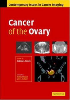 Hardcover Cancer of the Ovary Book