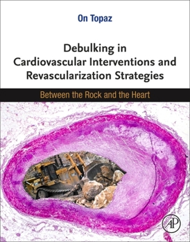 Paperback Debulking in Cardiovascular Interventions and Revascularization Strategies: Between a Rock and the Heart Book