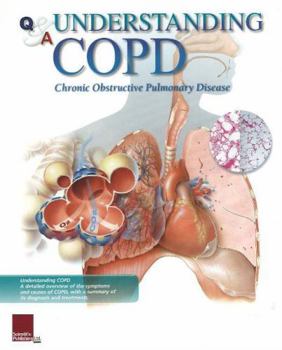 Paperback Understanding Copd Flip Chart Book