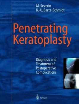 Hardcover Penetrating Keratoplasty: Diagnosis and Treatment of Postoperative Complications Book