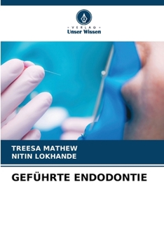 GEFÜHRTE ENDODONTIE (German Edition)