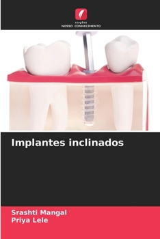 Implantes inclinados (Portuguese Edition)