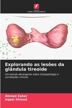 Paperback Explorando as lesões da glândula tireoide [Portuguese] Book