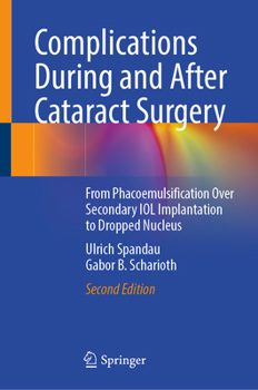 Hardcover Complications During and After Cataract Surgery: From Phacoemulsification Over Secondary Iol Implantation to Dropped Nucleus Book