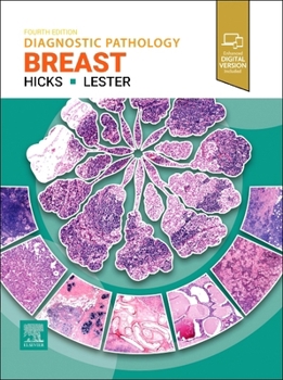 Hardcover Diagnostic Pathology: Breast Book