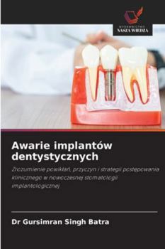 Paperback Awarie implantów dentystycznych [Polish] Book