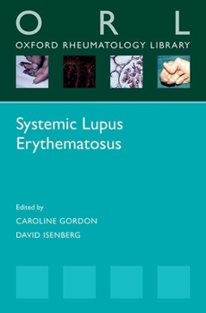 Paperback Systemic Lupus Erythematosus Book