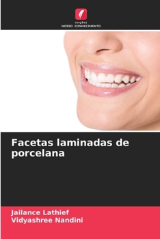 Paperback Facetas laminadas de porcelana [Portuguese] Book