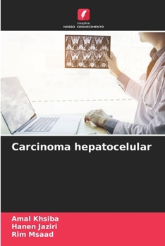 Paperback Carcinoma hepatocelular [Portuguese] Book