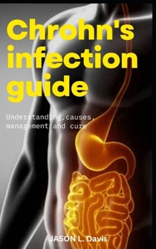 Paperback Crohns Infection Guide: Understanding Causes, Management And Cure Book