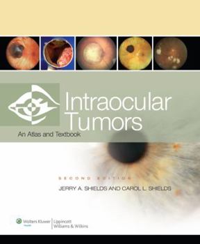 Hardcover Intraocular Tumors: An Atlas and Textbook Book