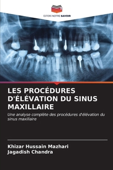 Paperback Les Procédures d'Élévation Du Sinus Maxillaire [French] Book