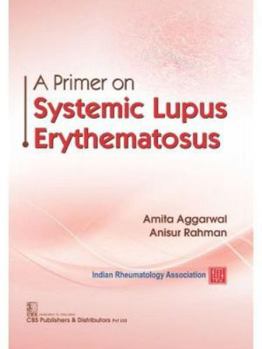 Paperback A Primer on Systemic Lupus Erythematosus Book