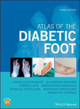 Hardcover Atlas of the Diabetic Foot Book