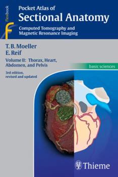 Paperback Pocket Atlas of Sectional Anatomy, Volume II: Computed Tomography and Magnetic Resonance Imaging Book