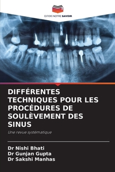 Paperback Différentes Techniques Pour Les Procédures de Soulèvement Des Sinus [French] Book