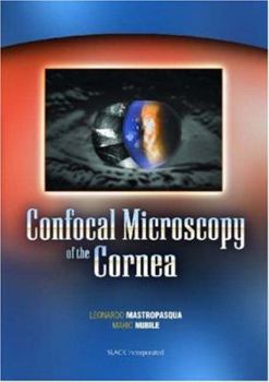 Hardcover Confocal Microscopy of the Cornea Book