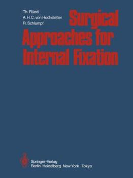 Paperback Surgical Approaches for Internal Fixation Book