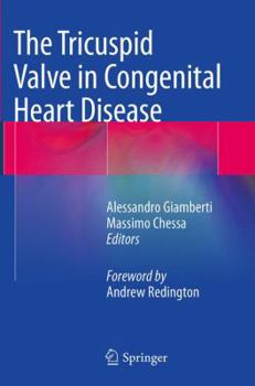 Paperback The Tricuspid Valve in Congenital Heart Disease Book