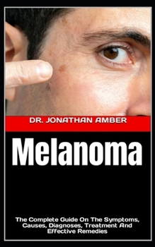 Paperback Melanoma: The Complete Guide On The Symptoms, Causes, Diagnoses, Treatment And Effective Remedies Book