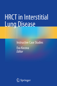 Hrct in Interstitial Lung Disease: Instructive Case Studies