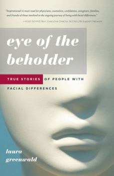 Paperback Eye of the Beholder: True Stories of People with Facial Differences Book