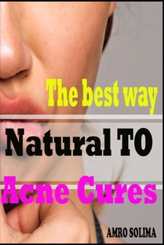 The best way Natural: TO Acne Cures