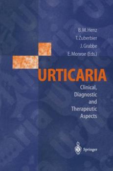 Paperback Urticaria: Clinical, Diagnostic and Therapeutic Aspects Book