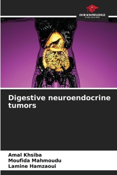 Paperback Digestive neuroendocrine tumors Book