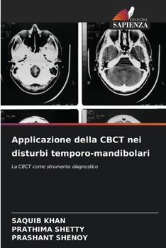 Paperback Applicazione della CBCT nei disturbi temporo-mandibolari [Italian] Book