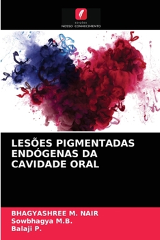 Paperback Lesões Pigmentadas Endógenas Da Cavidade Oral [Portuguese] Book