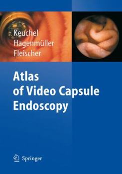 Atlas Of Video Capsule Endoscopy