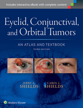 Hardcover Eyelid, Conjunctival, and Orbital Tumors: An Atlas and Textbook Book