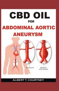 Paperback CBD Oil for Abdominal Aortic Aneurysm: All You Need to Know about How CBD Oil Works for AAA Book