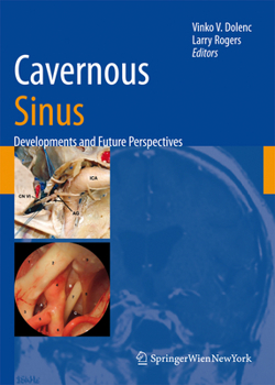 Paperback Cavernous Sinus: Developments and Future Perspectives Book