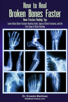 Paperback How to Heal Broken Bones Faster. Bone Fracture Healing Tips: Learn About Bone Fracture Healing Foods, Types of Bone Fractures, and the Five Stages of Book