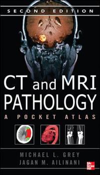 Paperback CT & MRI Pathology: A Pocket Atlas, Second Edition Book