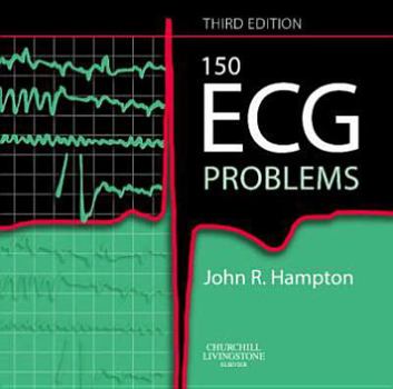 Paperback 150 ECG Problems Book