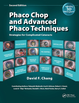 Hardcover Phaco Chop and Advanced Phaco Techniques: Strategies for Complicated Cataracts [With DVD] Book