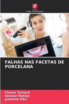 Paperback Falhas NAS Facetas de Porcelana [Portuguese] Book