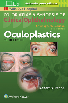 Paperback Oculoplastics Book
