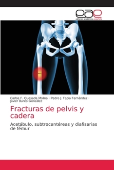 Fracturas de pelvis y cadera: Acetábulo, subtrocantéreas y diafisarias de fémur