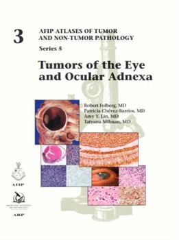 Hardcover Tumors of the Eye and Ocular Adnexa (AFIP Atlas of Tumor and Non-Tumor Pathology, Series 5) Book