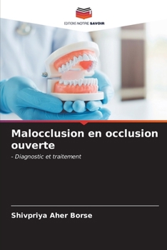 Paperback Malocclusion en occlusion ouverte [French] Book