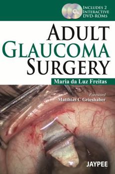 Adult Glaucoma Surgery [With 2 DVD ROMs]