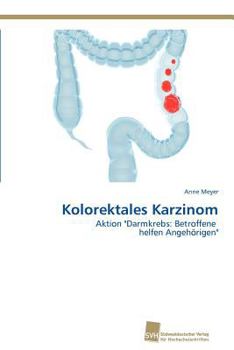 Paperback Kolorektales Karzinom [German] Book