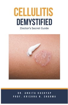 Paperback Cellulitis Demystified: Doctor's Secret Guide Book